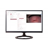 Cervixmap standard package